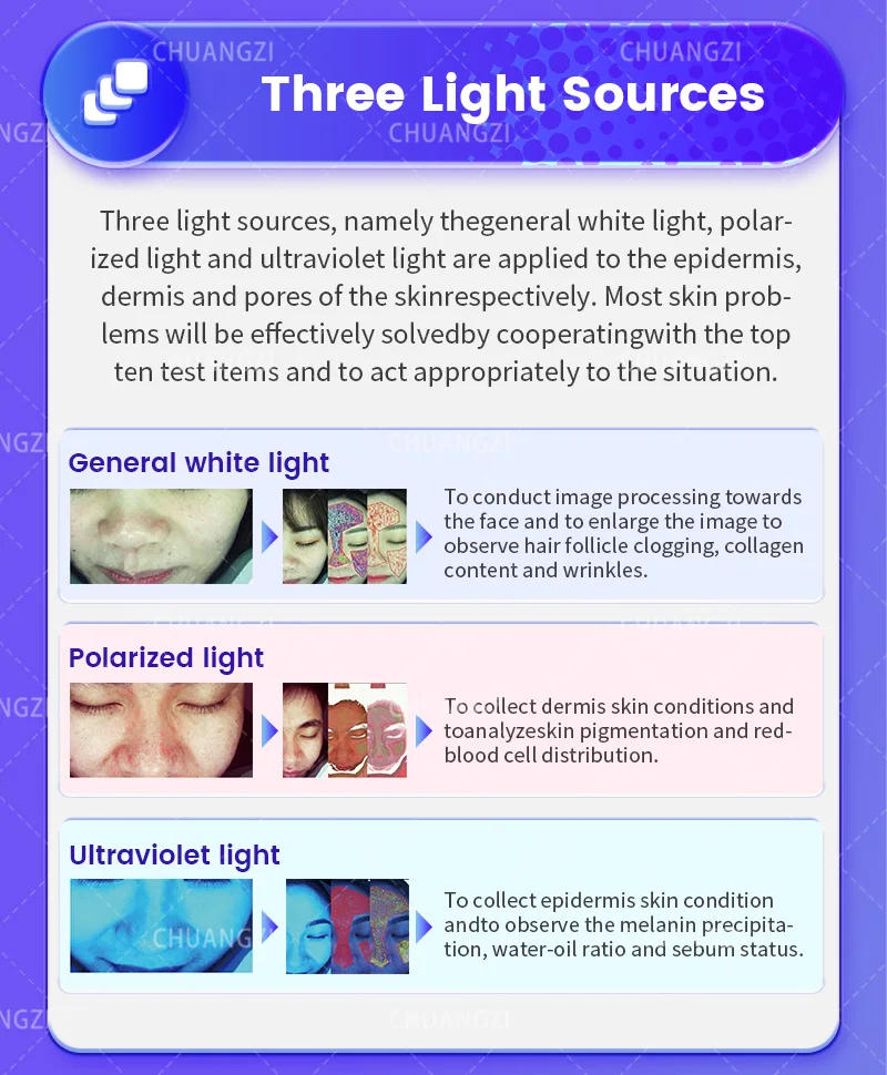 Description Picture 6 of itemNEWEST Skin Analyzer AI Intelligent Image Instrument Detector Magic Mirror 3D Digital Facial Analysis Machine Product