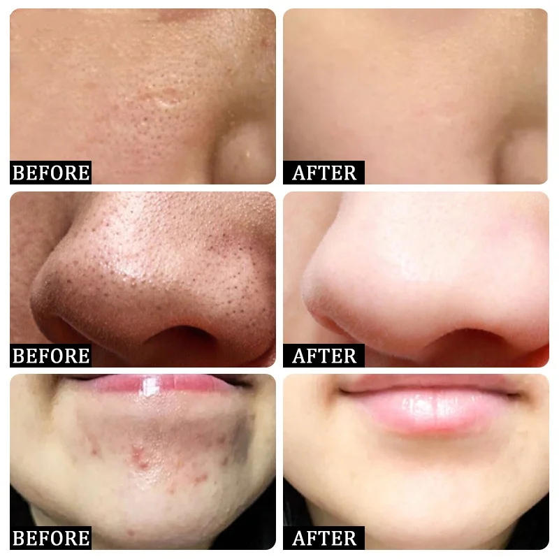 Description Picture 2 of itemBlackhead Remover Mask Bamboo Charcoal Shrink Pores Acne Black Head Removal Cream Nose Cleansing Black Peel Off Masks Skin Care