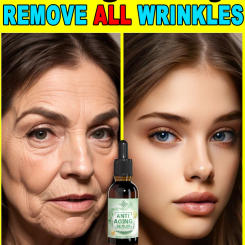 wrinkles disappeared