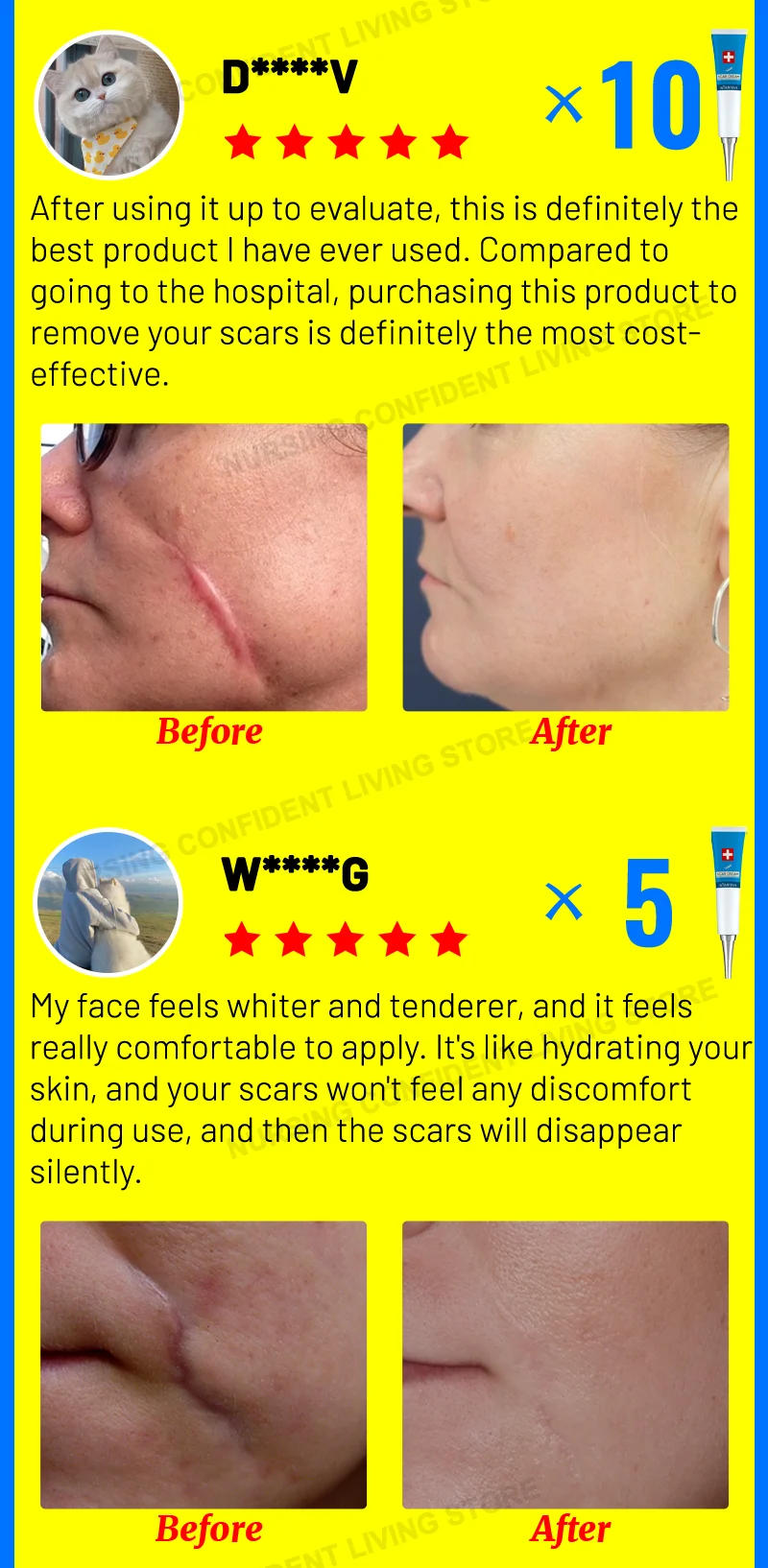 Description Picture 5 of itemDeep scar healing Scar gel for all new and old scars