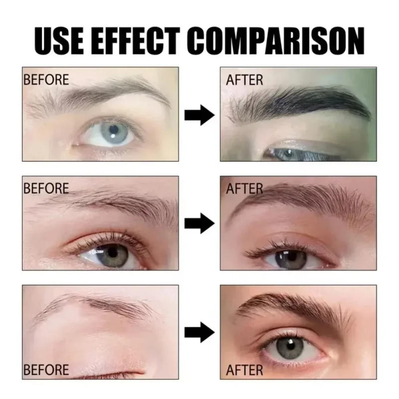 Description Picture 5 of itemEyebrow Growth Serum Eyelash Hair Growth Anti Hairs Loss Product Prevent Baldness Fuller Thicker Lengthening Eyebrow Makeup 30ml