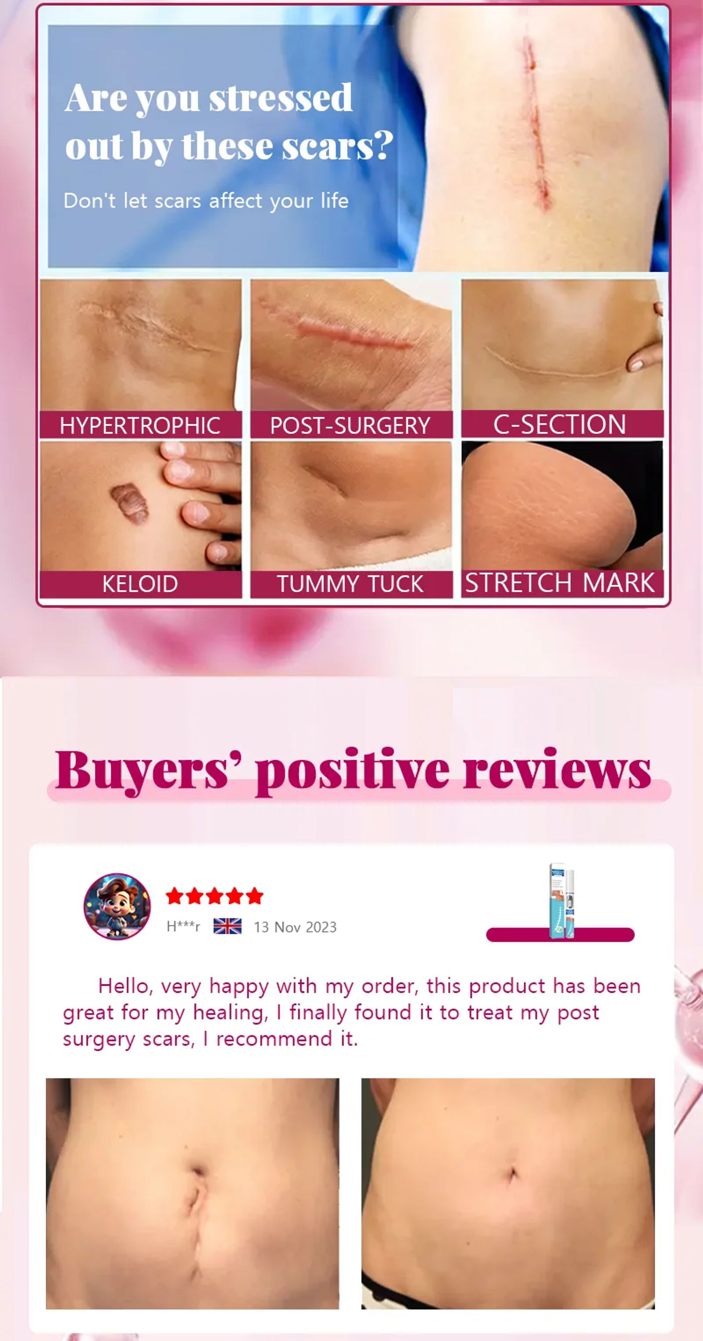 Description Picture 3 of itemSafe and scar-free