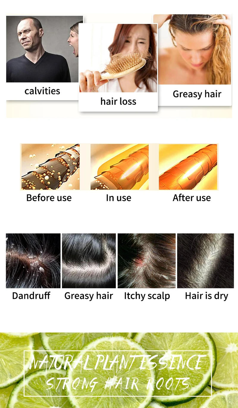 Description Picture 3 of itemLemon plant shampoo is refreshing, oil controlling, dandruff reducing, and strong for hair. Handmade shampoo without silicone oi