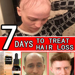 Unisex Hair Growth Oil Hair Loss Treatment Rapid Hair Growth Effective Baldness Repair Hereditary Postpartum