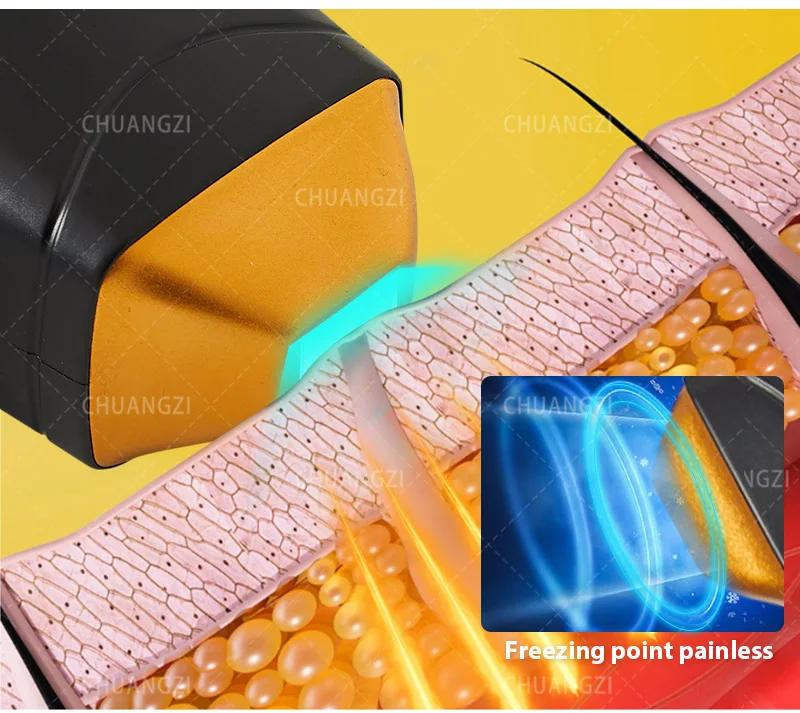 Description Picture 5 of itemPortable laser hair removal device 755nm 808nm 1064nm3 wavelength diode TEC cooling 3000w laser permanent painless hair removal