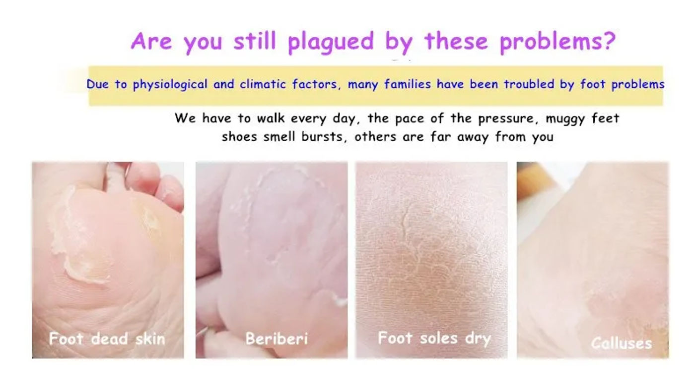 Description Picture 5 of itemBIOAQUA Shea Butter Foot Exfoliating Cream Moisturizing Remove Dead Skin Exfoliant Feet Pedicure Cream Foot Care Exfoliator
