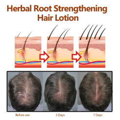 New Sdottor 100ml Eelhoe Herbal Root Dense Hair Lotion Hair Fixing Thick Hairline Repair Hair Care Moisturizing Hairs Anti-Fall