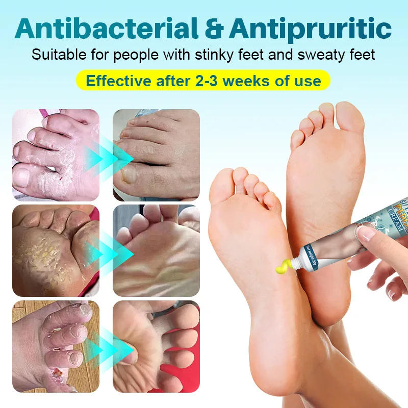 Description Picture 4 of itemFoot Deodorant Cream Foot Odor Bacteriostasis Antipruritic Athlete's Foot Ointment Skin Topical Cream Personal Health Care