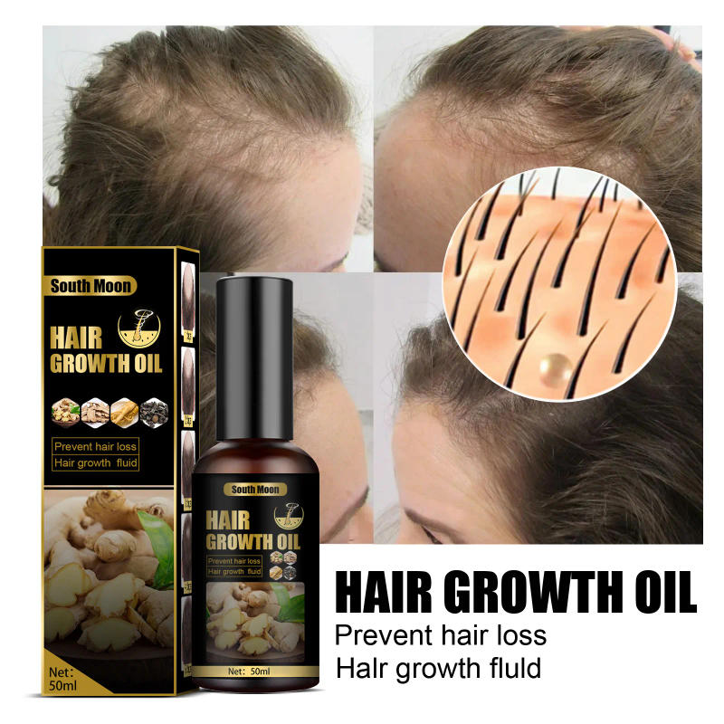 Description Picture 2 of itemHair Growth Essential Oils Repair Damaged Hair Anti Hair Loss Prevent Hair Loss Oil Ginger Fast Growing Hair Essential Oil