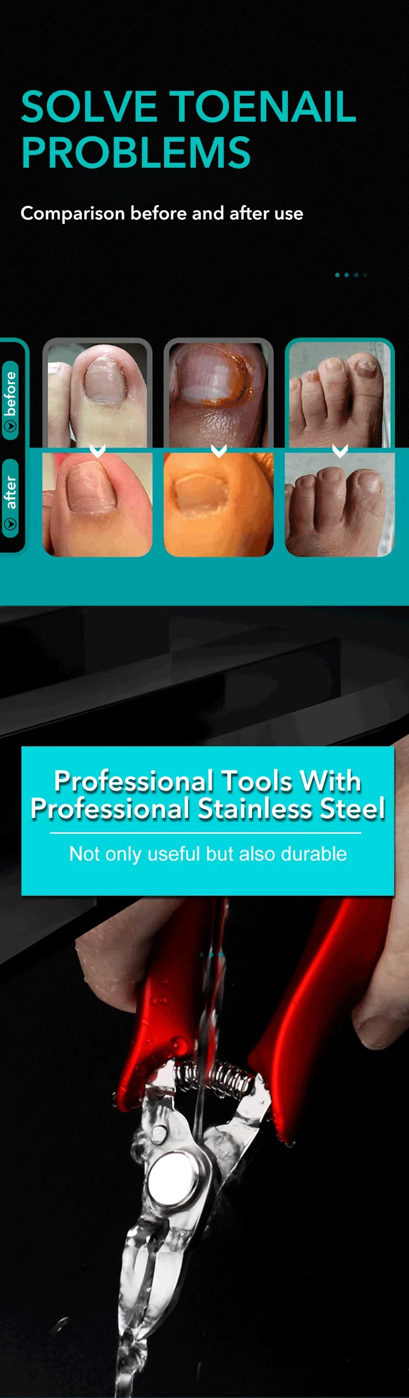 Description Picture 3 of item1Pcs Professional Toe Nail Clippers Manicure Pedicure Cutters Nippers Podiatry Claw Cutter Cuticle Scissors Cut Toenails Tools