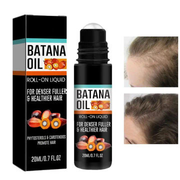 Batana Oil for Hair Growth Batana Oil Roller Balls Nourishes hair roots repairs dry and frizzy hair prevents hair loss
