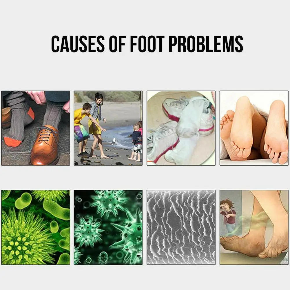 Description Picture 5 of itemSocks Shoes Deodorant Spray Shoes Stink Freshener Socks Odor Remover Spray Refresh Antiperspirant Foot Sweat Odor Remover