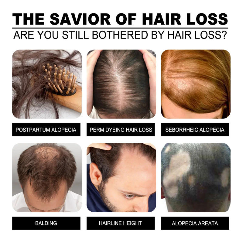 Description Picture 4 of itemAnti hair loss spray anti hair loss hair nutrition growth agent essence promotes hair growth,Hair essential oil.