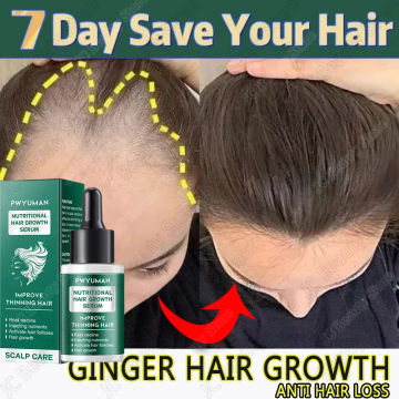 Ginger Hair Growth Products Anti Hair Loss Fast Grow Oil Thicken Essential Oil ScalpTreatment Hair Care Beauty Health Men Women
