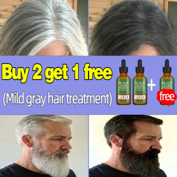 Gray Hair Treatment Serum White to Black Natural Color Repair Nourishing Products Anti-Hair Loss Care Men Women