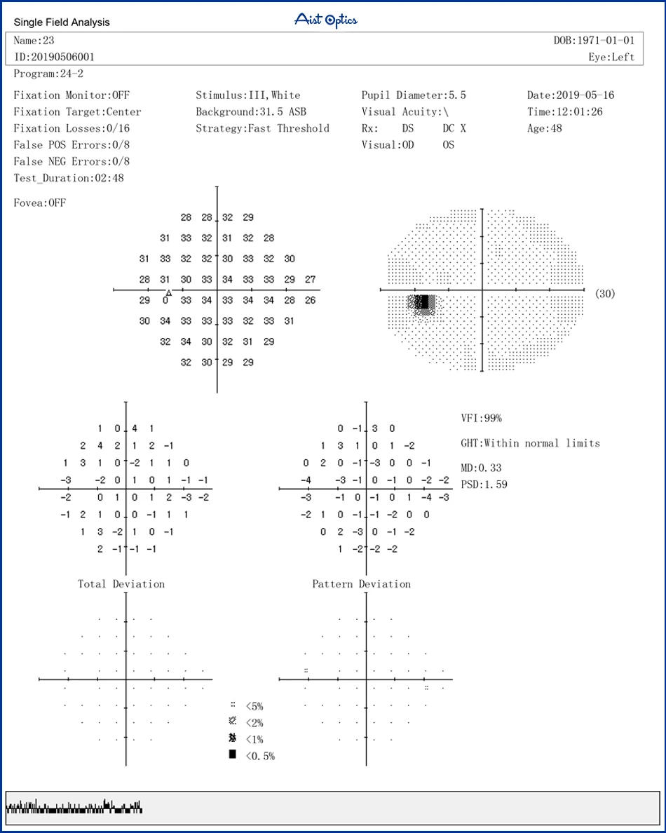 Description Picture 6 of itemAutomatic Eyeball Peripheral Vision Auto Perimeter Visual Field Analyzer with Printer Optical Instruments Ophthalmic Equipment