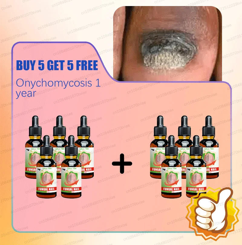 Description Picture 3 of itemEliminate nail problems