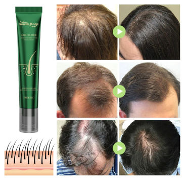 2pcs Hair Growth Oil Effective Baldness Repair Hereditary Postpartum Seborrheic Hair Loss for Women & Men Fast Hair Growth Oil