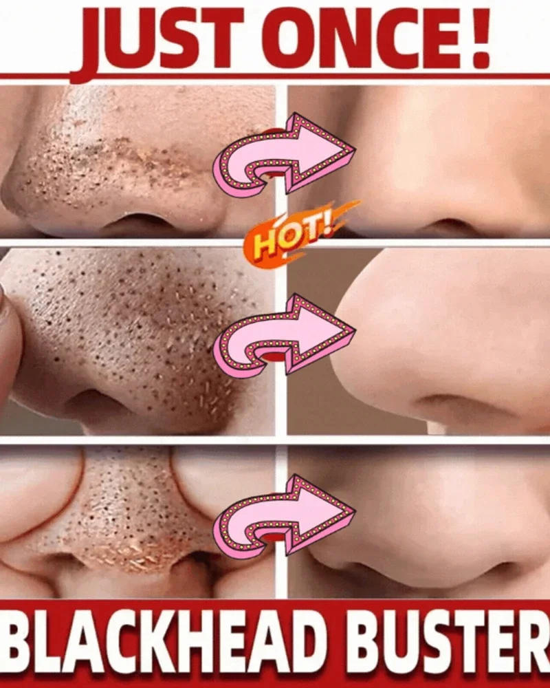 Description Picture 2 of itemShrink Pores Mask Salicylic Acid Deep Cleansing Stick Kaolin Clay Refines Skin Remove Forehead Blackhead Chin Pimples Acne Treat