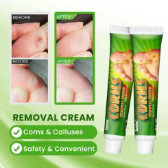 30g Foot Corn Remover Cream Chicken Eye Skin Infection Treatment Ointment Feet Dead Skin Calluses Removal Tool Health Care