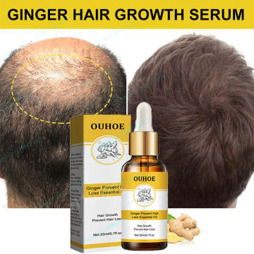 Ginger Hair Care Essential Oil 7 Day Improves Scalp Environment Hair Loss Treatment Hair Growth Care Essence Oil