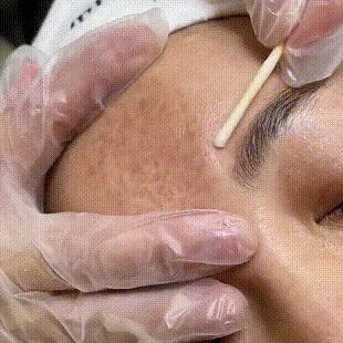 Description Picture 2 of itemWhitening Freckles Face Cream Removal Melasma Dark Spots Corrector Lighten Melanin Pigmentation Brighten Anti-Aging Beauty Care