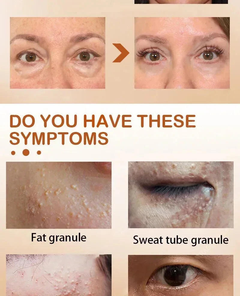 Description Picture 5 of item26 Anti-Aging Moisturizer Eye Cream Dilutes Around The Eyes To Remove Dark Circles, Eye Bags, Collagen Firming Eye Cream