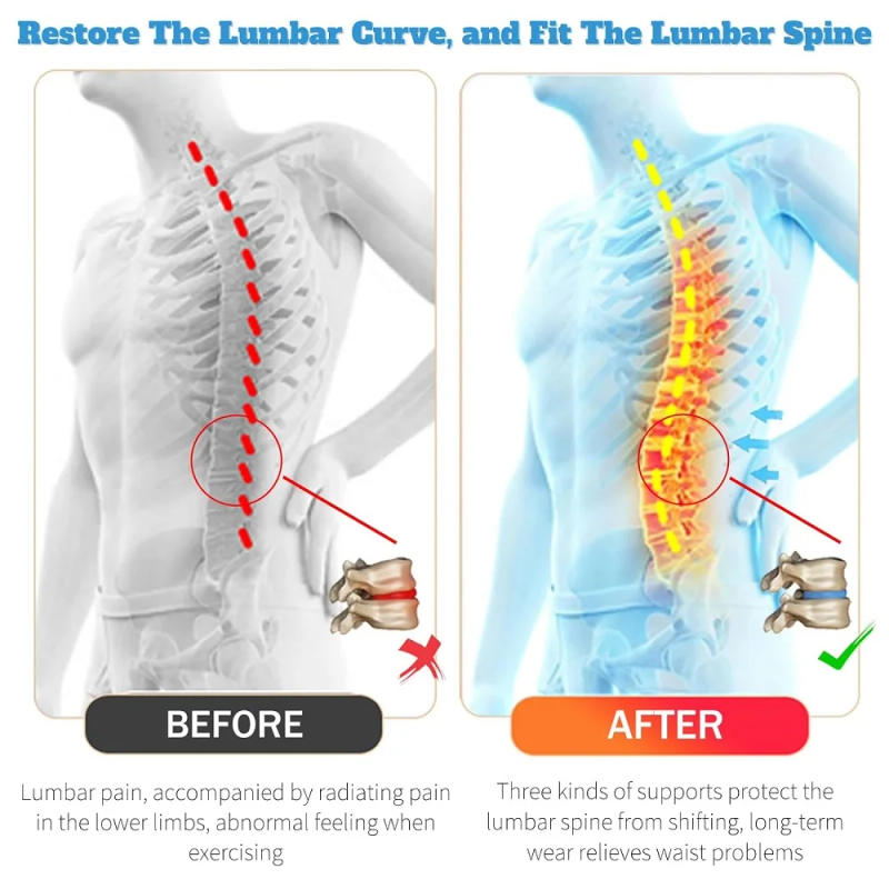 Description Picture 5 of itemAdjustable Back Brace for Men & Women - Breathable Waist Lumbar Lower Back Support Belt for Sciatica, Herniated Disc, Scoliosis