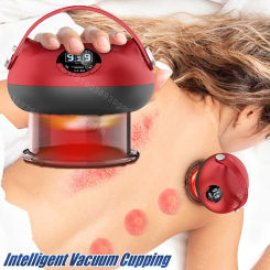Intelligent Vacuum Cupping Massage Device Electric Heating Scraping Suction Cups Physical Fatigue Relieve Health Guasha Cans
