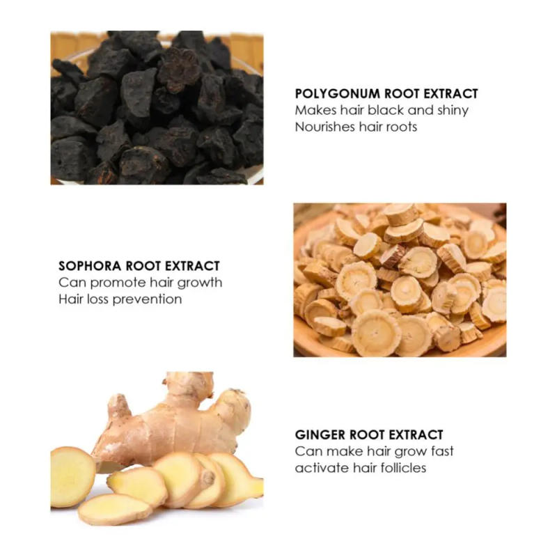 Description Picture 4 of itemFast Hair Growth Oil Hair Regrowth Serum Hair Thinning Hair Growth Liquid Anti-Hair Loss For Women And Men Hair Loss Product