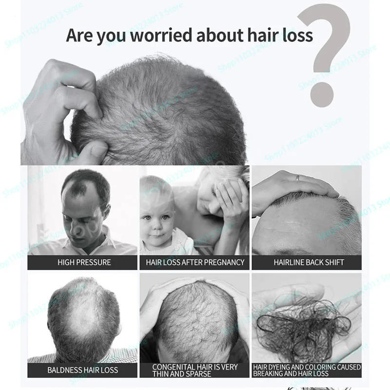 Description Picture 4 of itemhair growth treatment Oil fast hair growth products  Anti Hair Loss Hair Scalp Treatment Serum Beauty Health