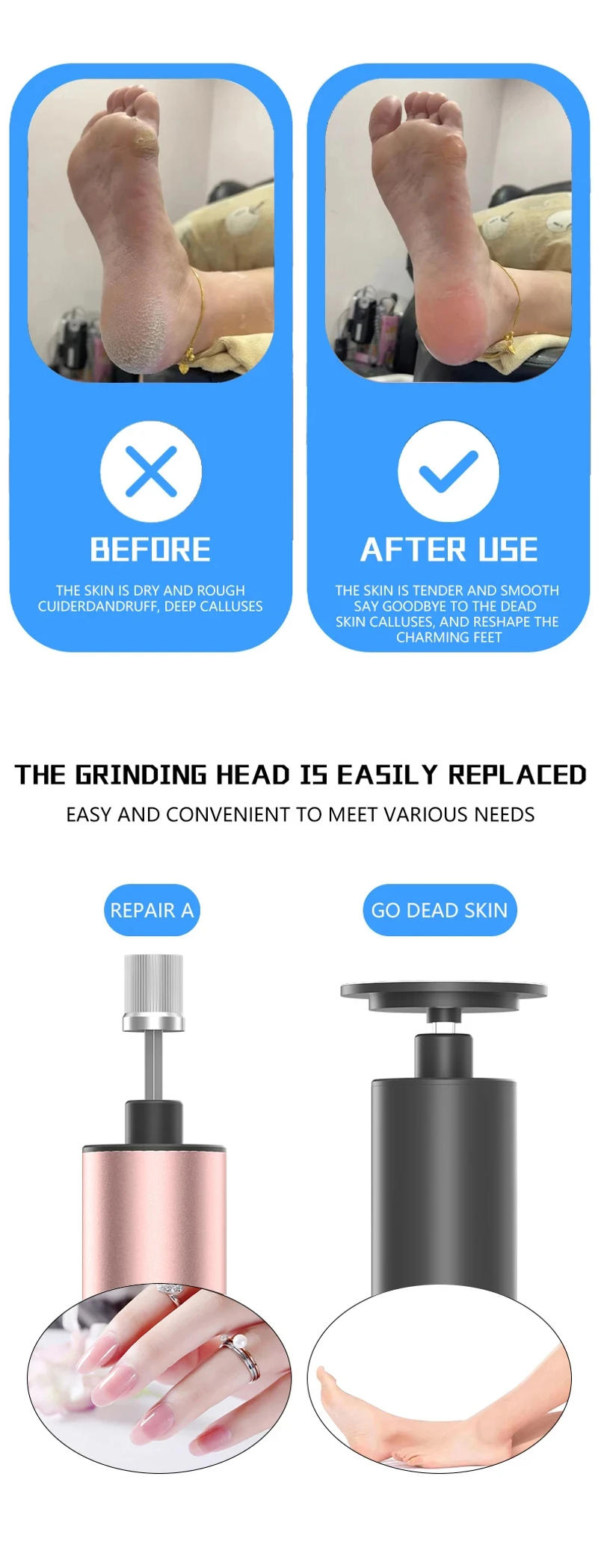 Description Picture 4 of itemFoot Care File Electric Foot Callus Remover Leg Heels Remove Dead Skin Pedicure Tool Set and Replacement Sandpaper