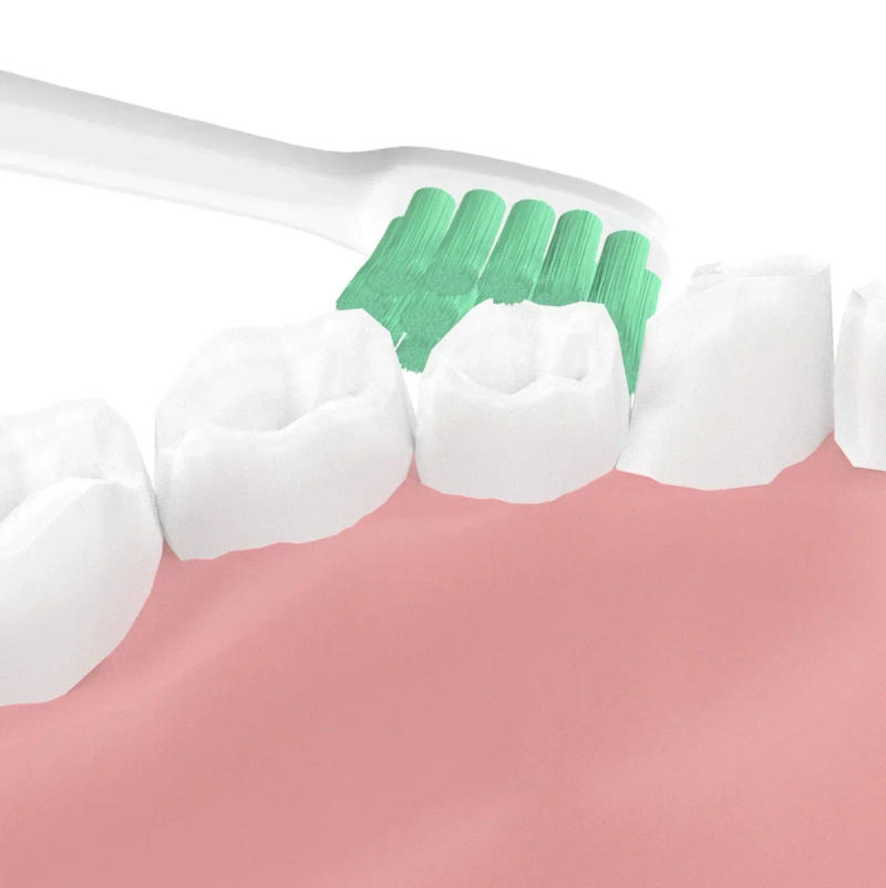 Description Picture 4 of item8pc Sonic Electric Replacement Tooth Brush heads for Xiaomi Mijia X3 Tooth Brush Head / Soocas X3 X1 X5 Toothbrush Heads