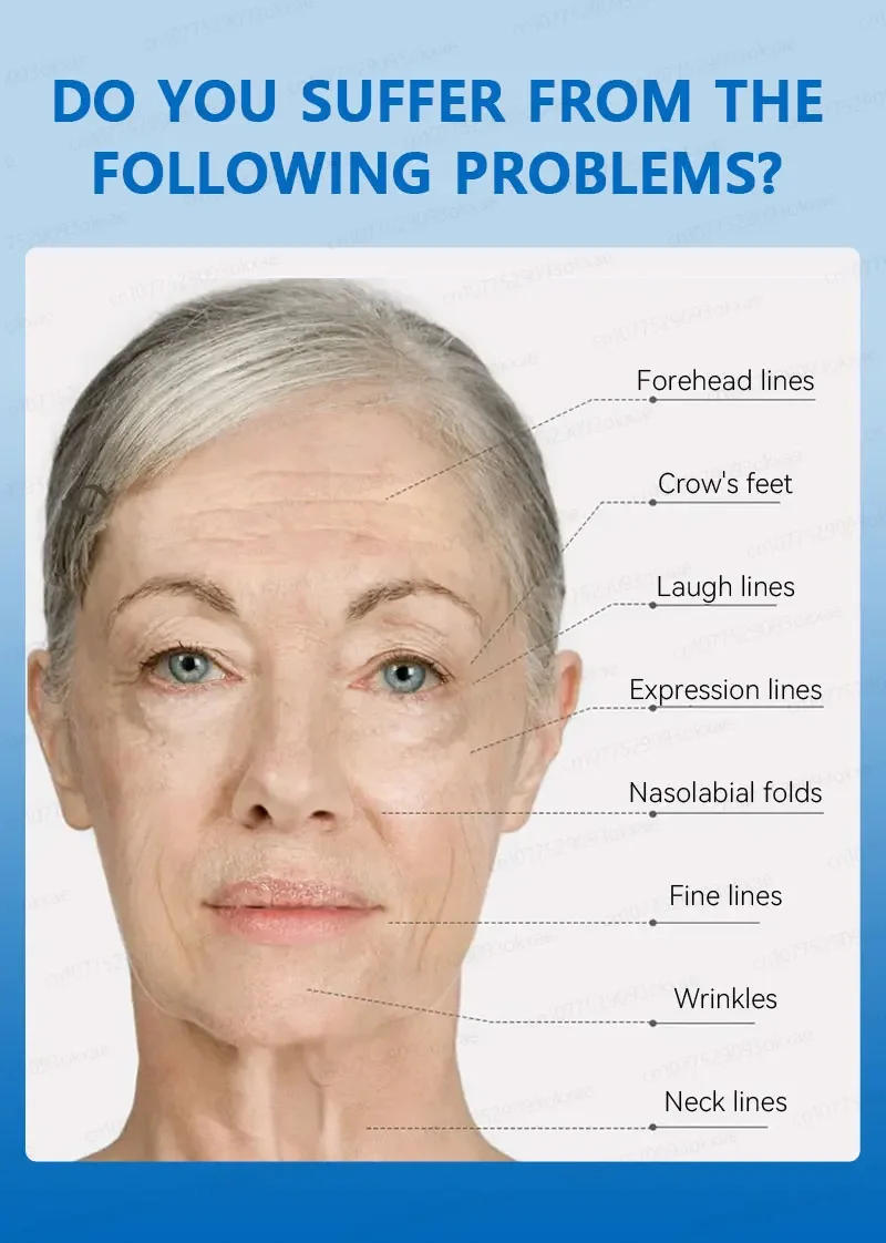 Description Picture 6 of itemwrinkles disappeared