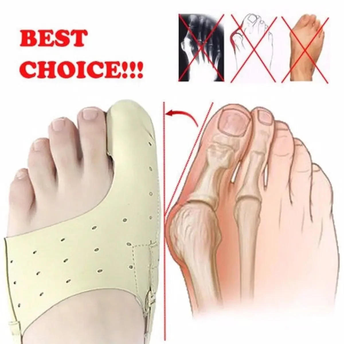 Description Picture 2 of itemعلاج الاسترخاء Foot Care Tool Elastic Bunion Corrector 1 Piece  Big Foot Bones Toe Separator Hallux Valgus Orthopedic Supplies