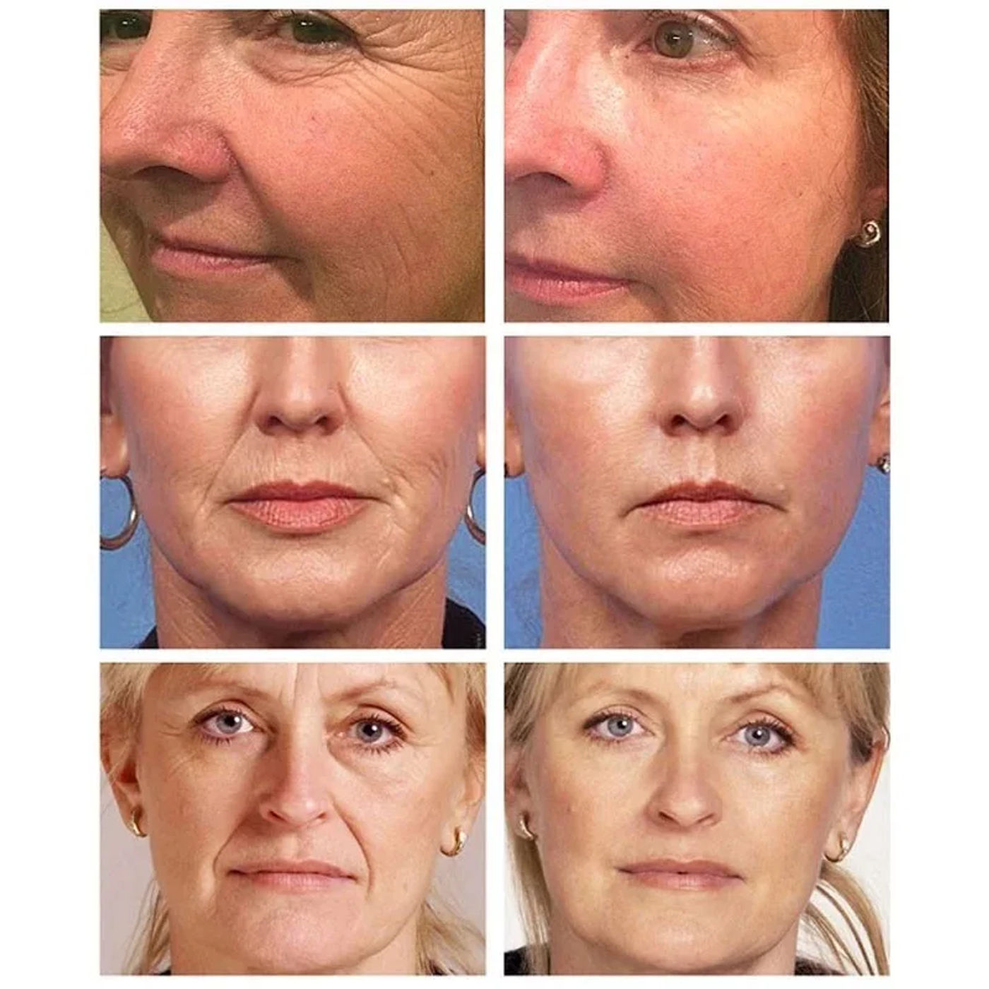 Description Picture 2 of itemWrinkle Remover Face Serum Lift Firm Fade Fine Lines Anti-aging Essence Collagen Anti-Wrinkle Whiten Brighten Skin Care Cosmetic