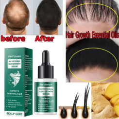 Ginger Hair Growth Serum Fast Growing Hair Care Oil Anti Hair Loss Baldness Scalp Treatment Repair Damaged Hair for Men Women