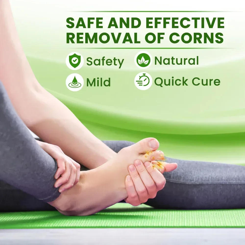 Description Picture 6 of item30g Foot Corn Remover Cream Chicken Eye Skin Infection Treatment Ointment Feet Dead Skin Calluses Removal Tool Health Care