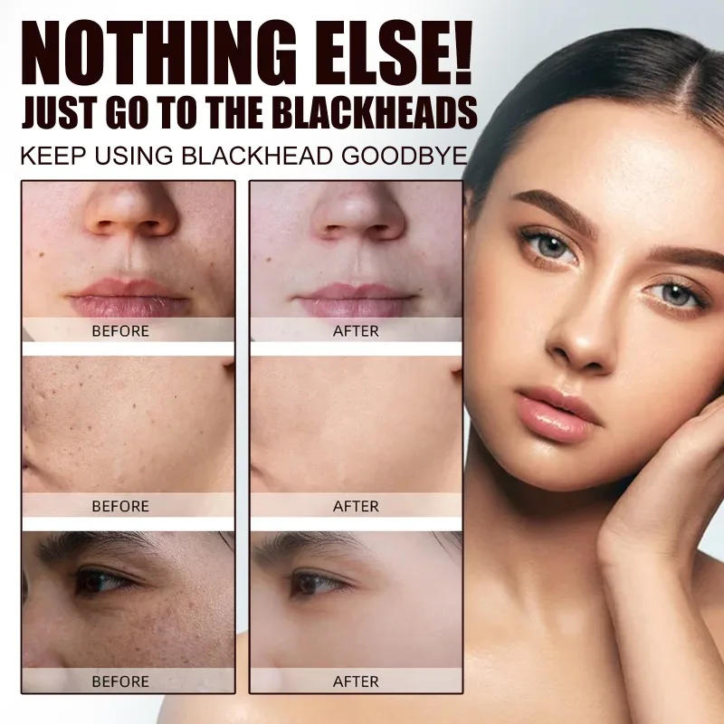 Description Picture 5 of itemWest&Month Black Tea Facial MaskCleanse PoresApplication MaskBrighten PoresBrighten ComplexionRejuvenate Facial Mask