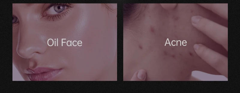 Description Picture 5 of itemBlack Head Remover Face Mask Bamboo Charcoal Black Dot T-zone Deep Cleaning for Women Men Blackhead Facial Skin Care Products