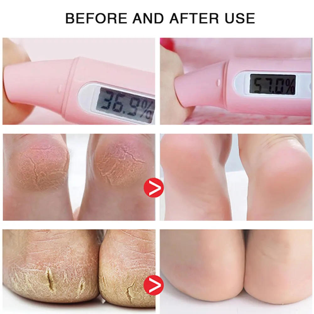 Description Picture 6 of itemHorse Oil Foot Cream Hand Foot Care Cream Moisturizing Anti-Aging Body Skin Moisturizing Removal Hand Care Mask Feet Pedicur