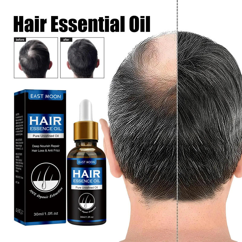 Description Picture 2 of itemUnisex Hair Growth Oil Hair Loss Treatment Rapid Hair Growth Effective Baldness Repair Hereditary Postpartum Hair Loss