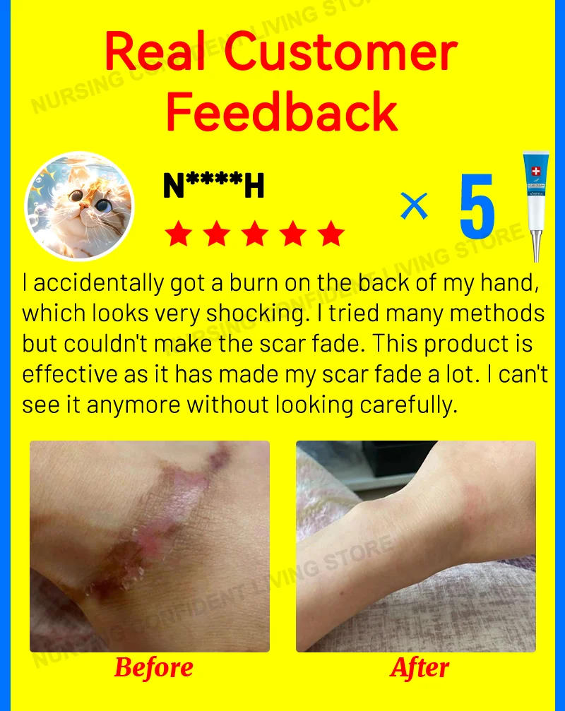 Description Picture 3 of itemDeep scar healing Scar gel for all new and old scars