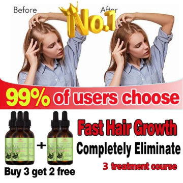 Rosemary Mint Hair Growth Essential Oil Anti Hair Loss Strengthen Nourishing Treatment Split Ends and Dry Scalp Care Men Women