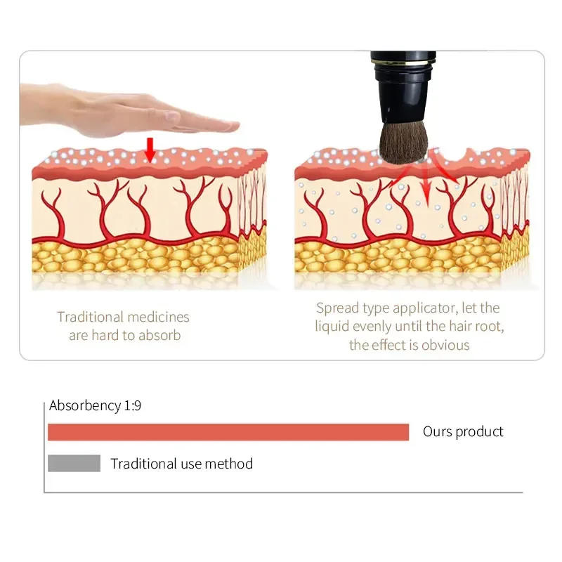 Description Picture 5 of itemScalp Oil Applicator Portable Mini Massage Comb Brush Scalp Massager Hair Growth Relaxation Treatment Scalp Care Tools