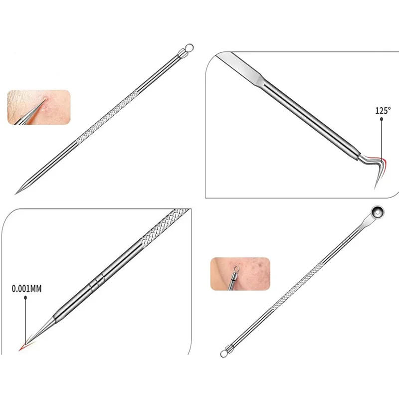 Description Picture 4 of itemBlackhead Remover Squeeze Acne Needle Tweezers Alema Blackheads Cell Clip 5 Extractor Pimples Comedon Black Dots Nose Sebum Tool