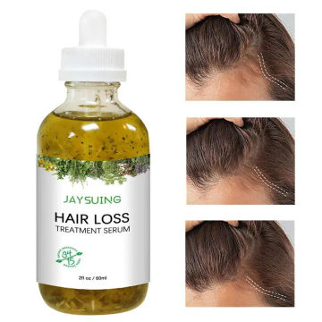 Hair Growth Essence Oil Hair Loss Oil Repair 60ml Hair Growth Serums Dry Damaged Hair Care Oils for Women and Men All Hair Types