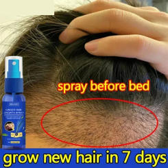 Hair Growth Spray Fast  Hair Growth Treatment Baldness Promote Thicker Longer Moisturize Anti Hair Loss Care Ginger Spray 30ML