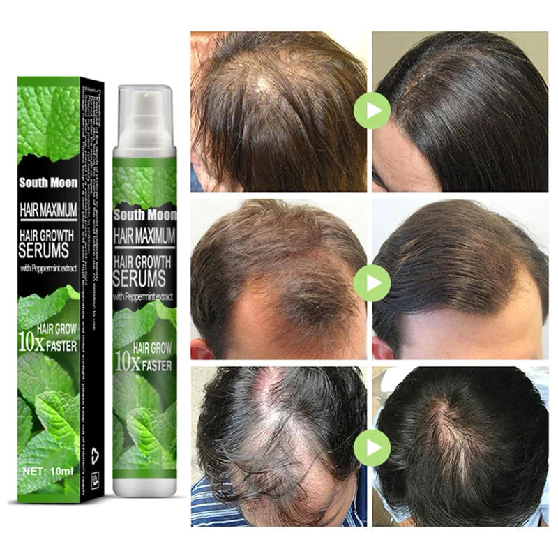 Description Picture 2 of item10/30ml Hair Growth Spray Fast Grow Hair Oil Hair Loss Cure for Thinning Hair Growth Spray Products Hair Care for Women Men