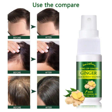 Ginger Hair Growth Spray Serum Anti Hair Loss Essential Oil Products Fast Prevent Hair Thinning Frizzy Repair